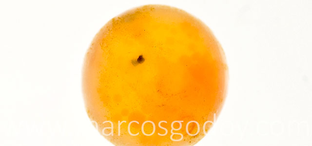 Microftalmia embrionaria VIII