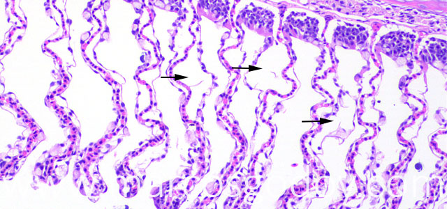 Chatonella histo 20X Xjpg