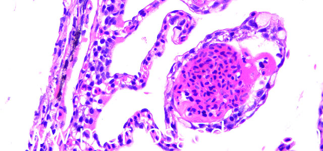 Chatonella histo 40X V