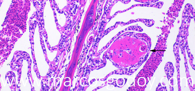 Chatonella histo 40X VII