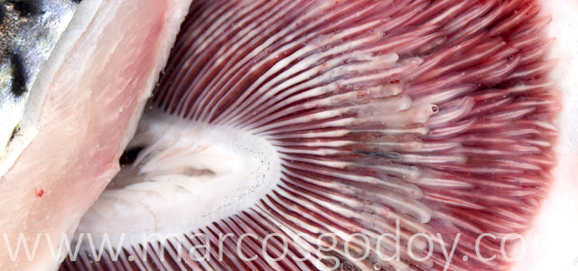 EPG patologia macroscopica IXI
