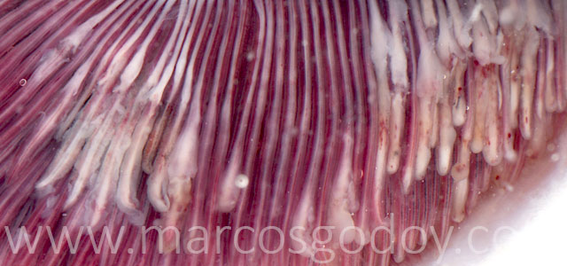 EPG patologia macroscopica V