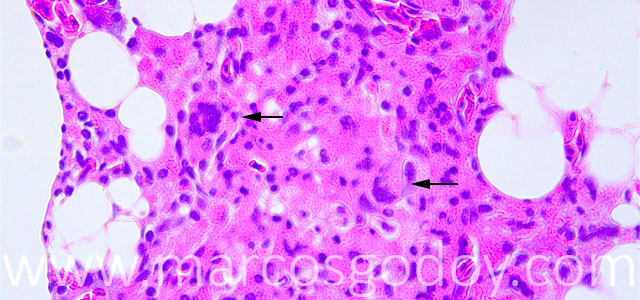 Esteatitis 40X VII