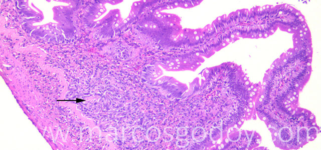 Enteritis 10X III