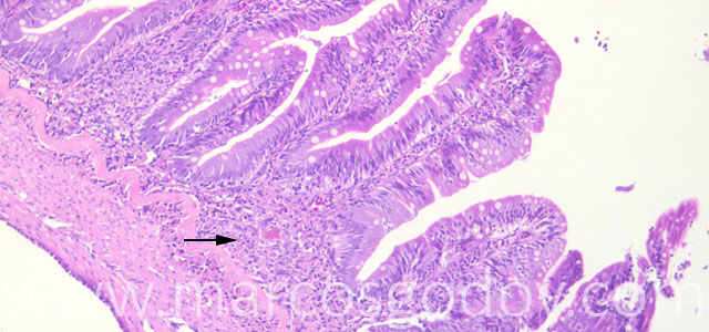 Enteritis 10X IV