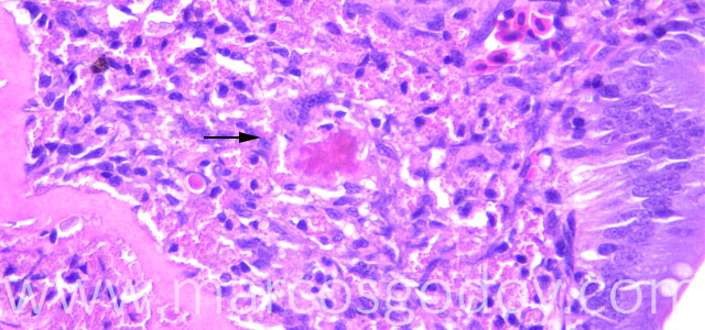 Enteritis 20X V
