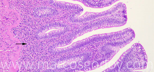 Enteritis 40X I