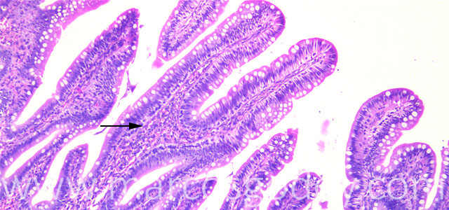 Enteritis 40X II