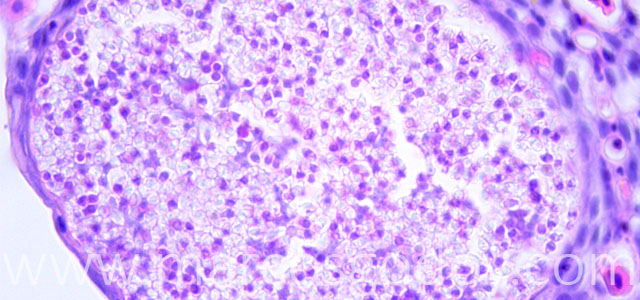 Microsporideo 100X XIV
