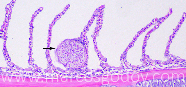 Microsporideo 20X VI