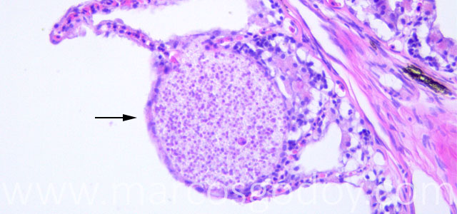 Microsporideo 40X VII