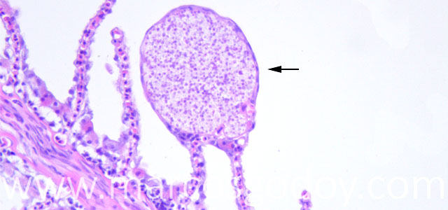 Microsporideo 40X VIII copy