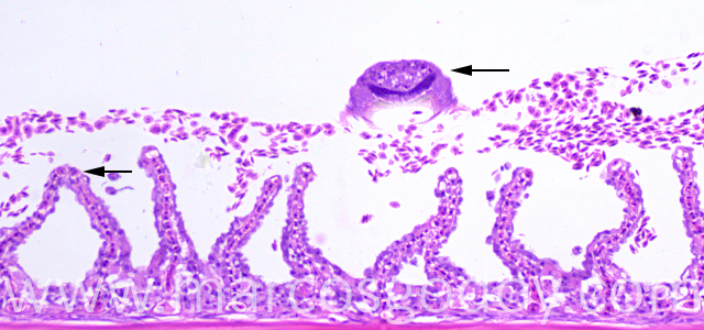 Trichodina 200X II