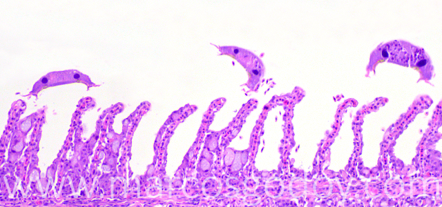 Trichodina 200X IV