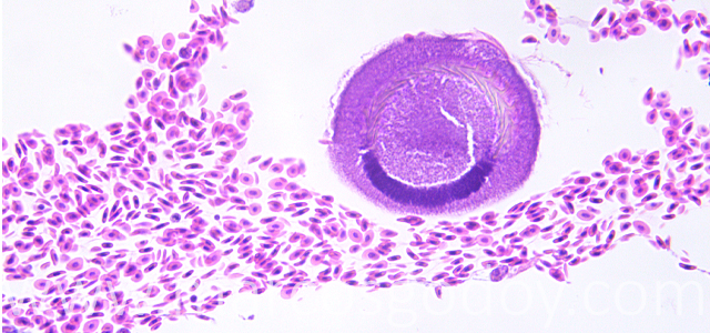 Trichodina 400X V