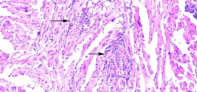 Miocarditis Altantic salmon 100X II