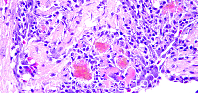 Miocarditis Altantic salmon 400X IX