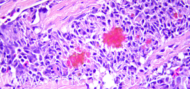 Miocarditis Altantic salmon 400X VIII