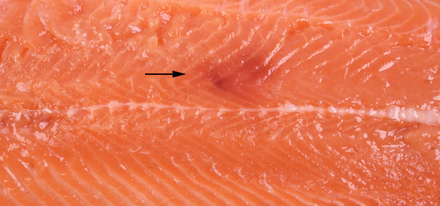 Hematoma VII