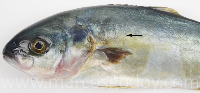 Seriola lesiones IV