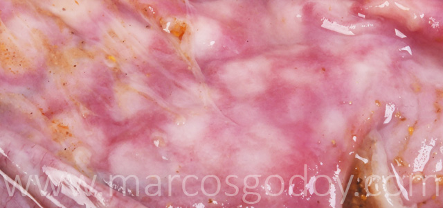 Gastritis coho salmon gross XII