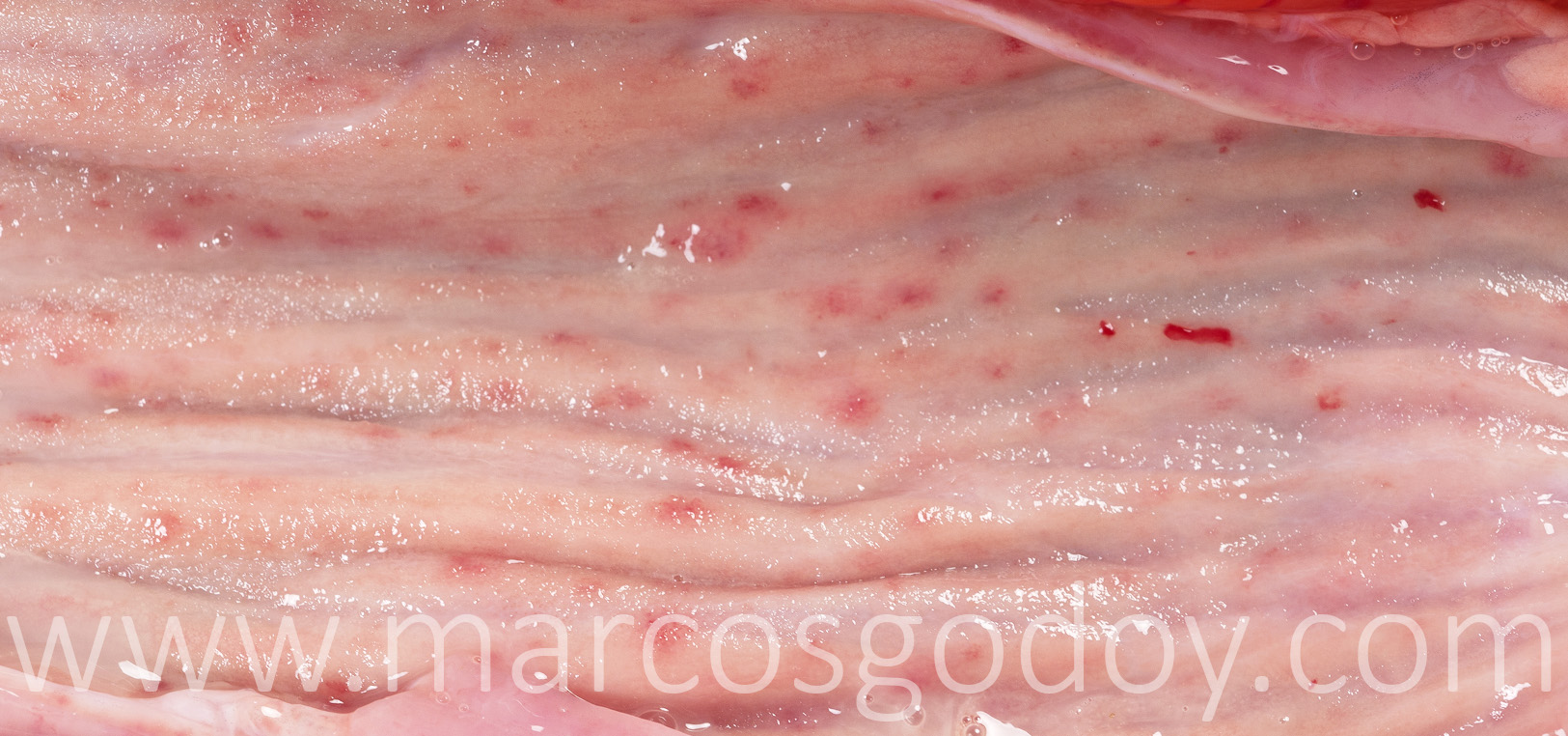 Gastritis salmon chinook IV