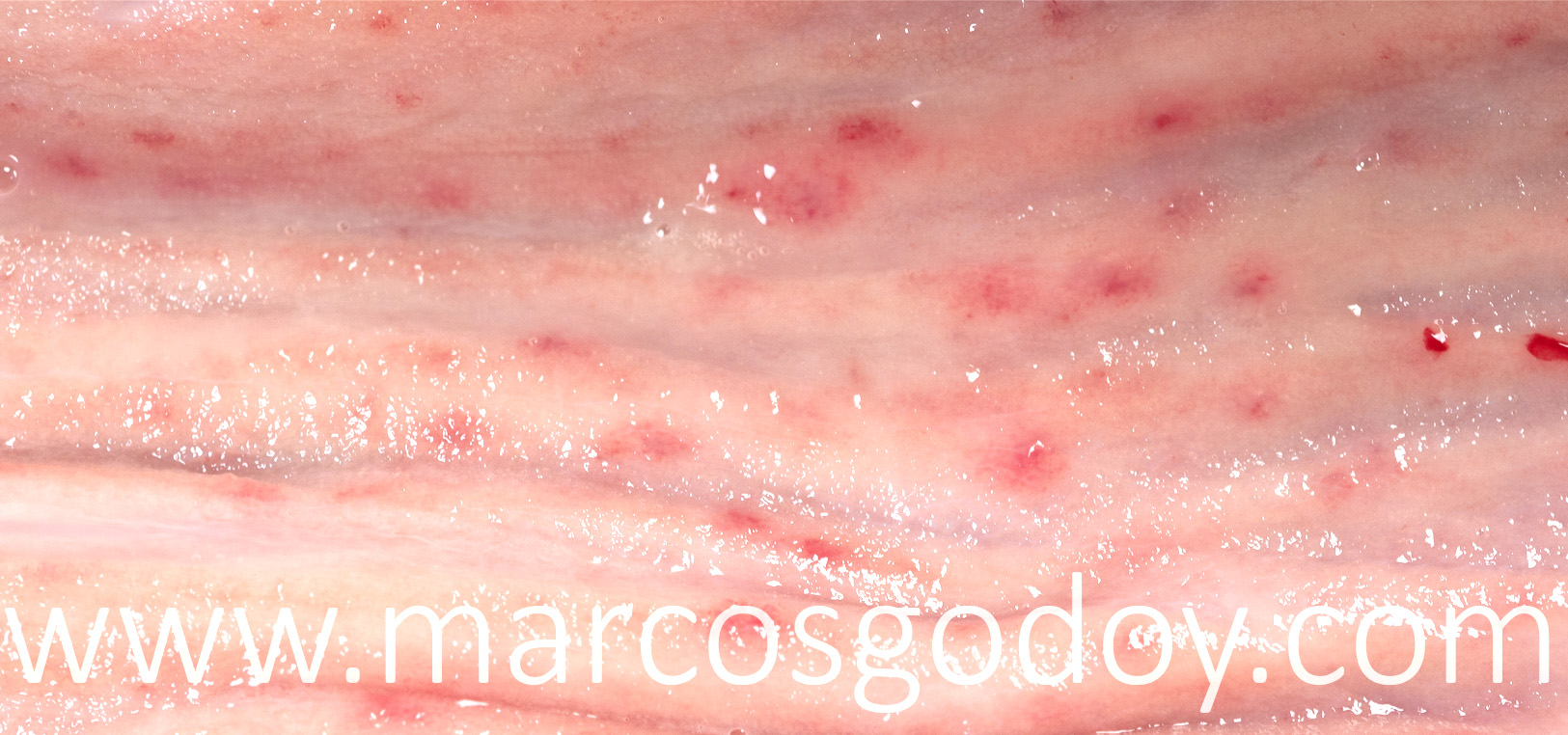 Gastritis salmon chinook V