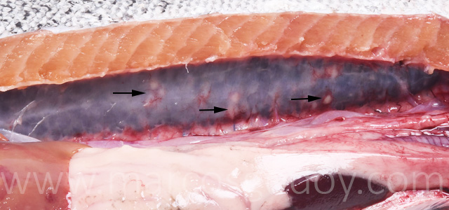 Hepatitis granulomatosa III