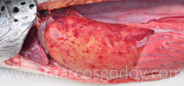Hepatitis granulomatosa III