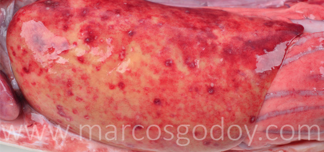 Hepatitis granulomatosa IV