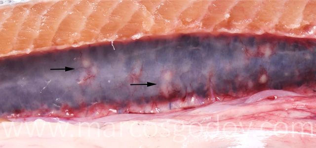 Hepatitis granulomatosa IV
