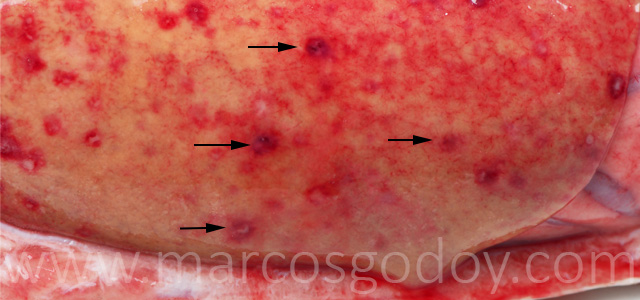 Hepatitis granulomatosa VIII