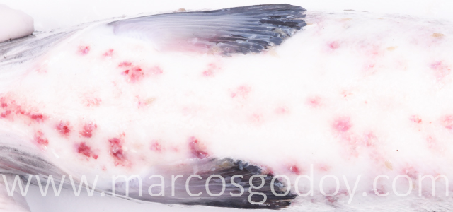 Hemorragias abdominales IX