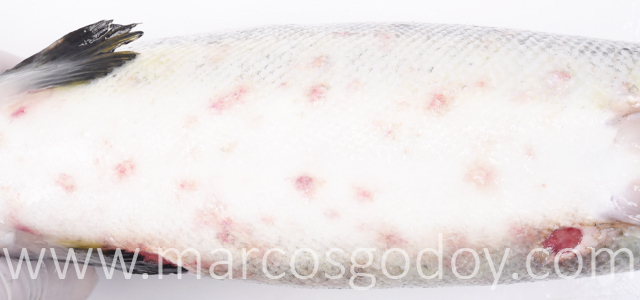 Hemorragias abdominales VII