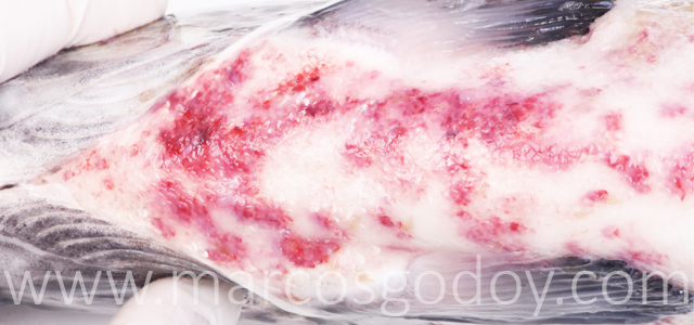 Hemorragias abdominales XII