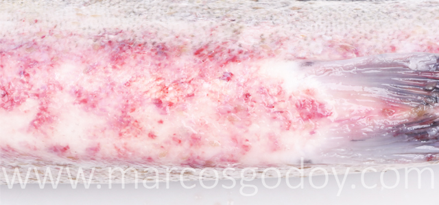 Hemorragias abdominales XIII