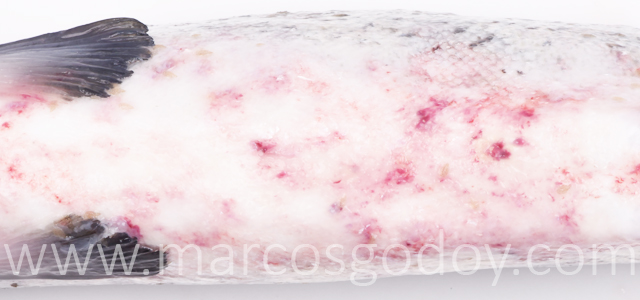 Hemorragias abdominales XV