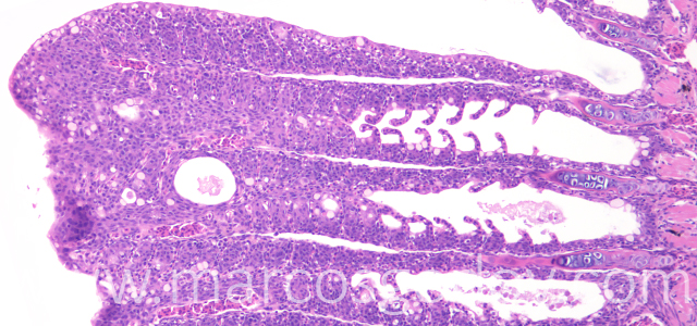 Lamellar fusion 100X VIII