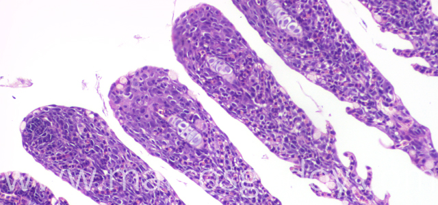 Lamellar fusion 10X III