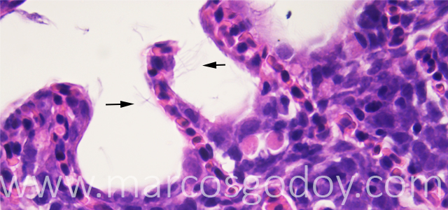 Lamellar fusion 400X IV