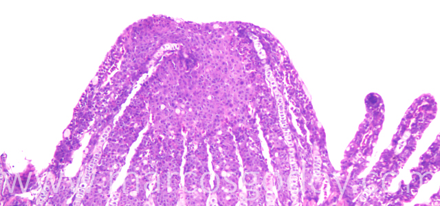 Lamellar fusion 40X I