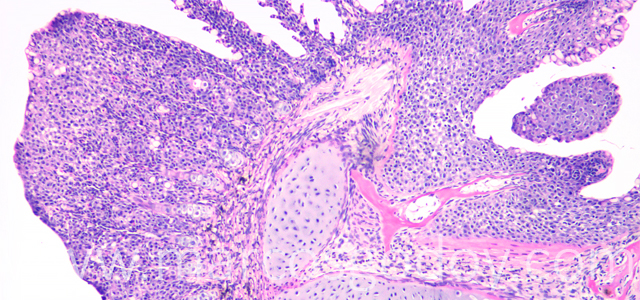 Lamellar fusion 40X II