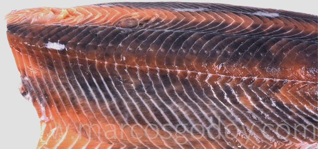 Melanosis difusa II