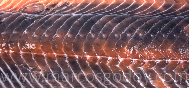 Melanosis difusa IV