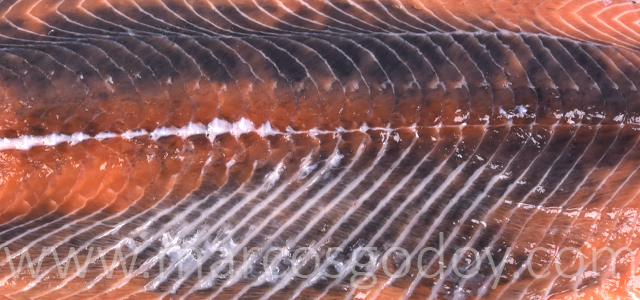 Melanosis difusa VI