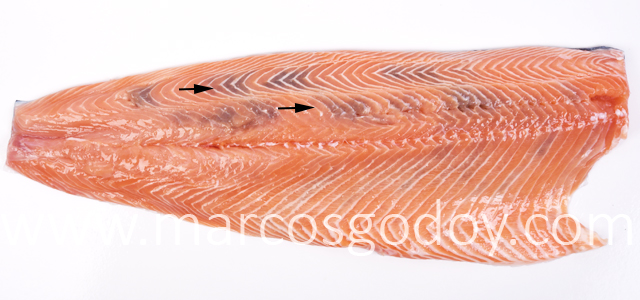 Melanosis muscular I