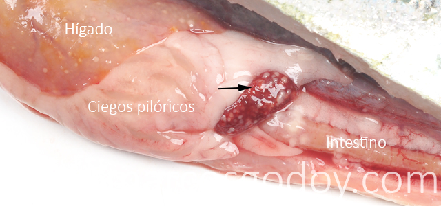Esplenitis granulomatosa I