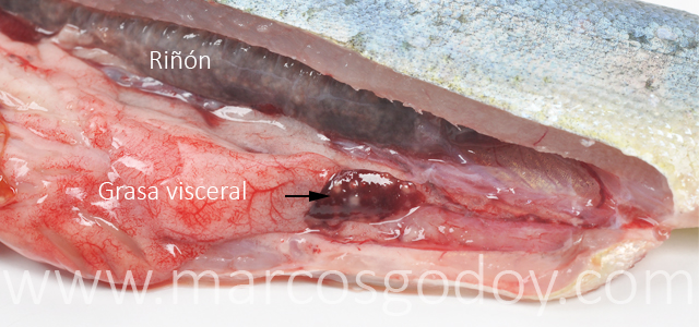 Esplenitis granulomatosa III