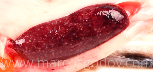 Esplenitis granulomatosa VIII