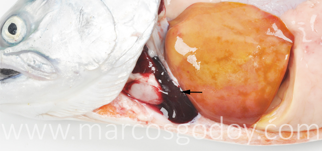 Hemopericardio Salmon coho II